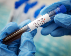 Рост смертности от коронавируса в России нашел новое объяснение